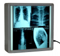 x-ray film viewer 1.jpg
